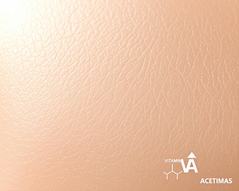 Terapia izotretynoiną: jak skutecznie leczyć trądzik? image-1765643259.jpg